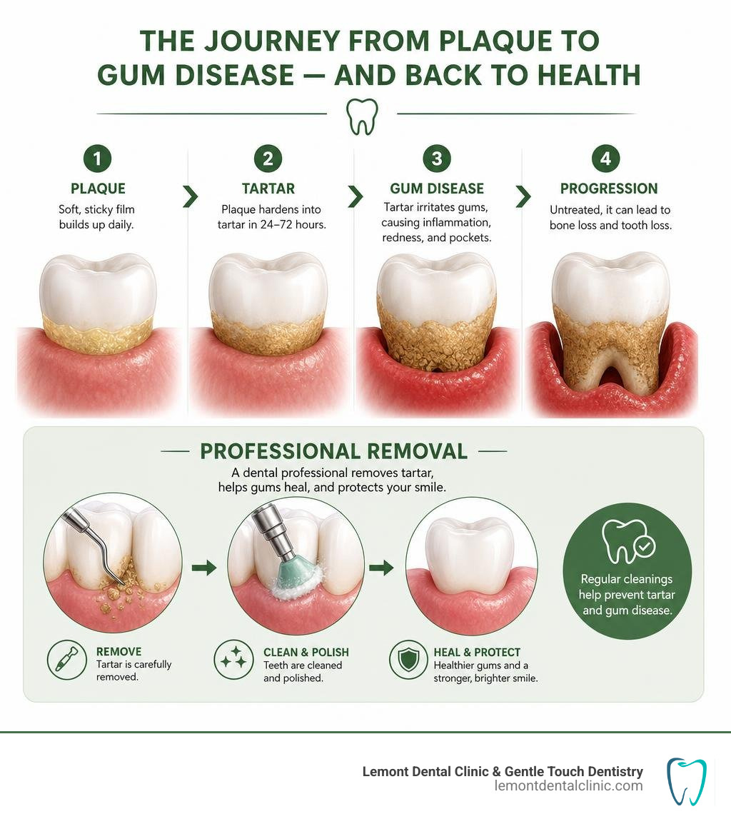Infographic showing the step-by-step transition from dental plaque to tartar to gum disease and professional removal Infographic showing the step-by-step transition from dental plaque to tartar to gum disease and professional removal