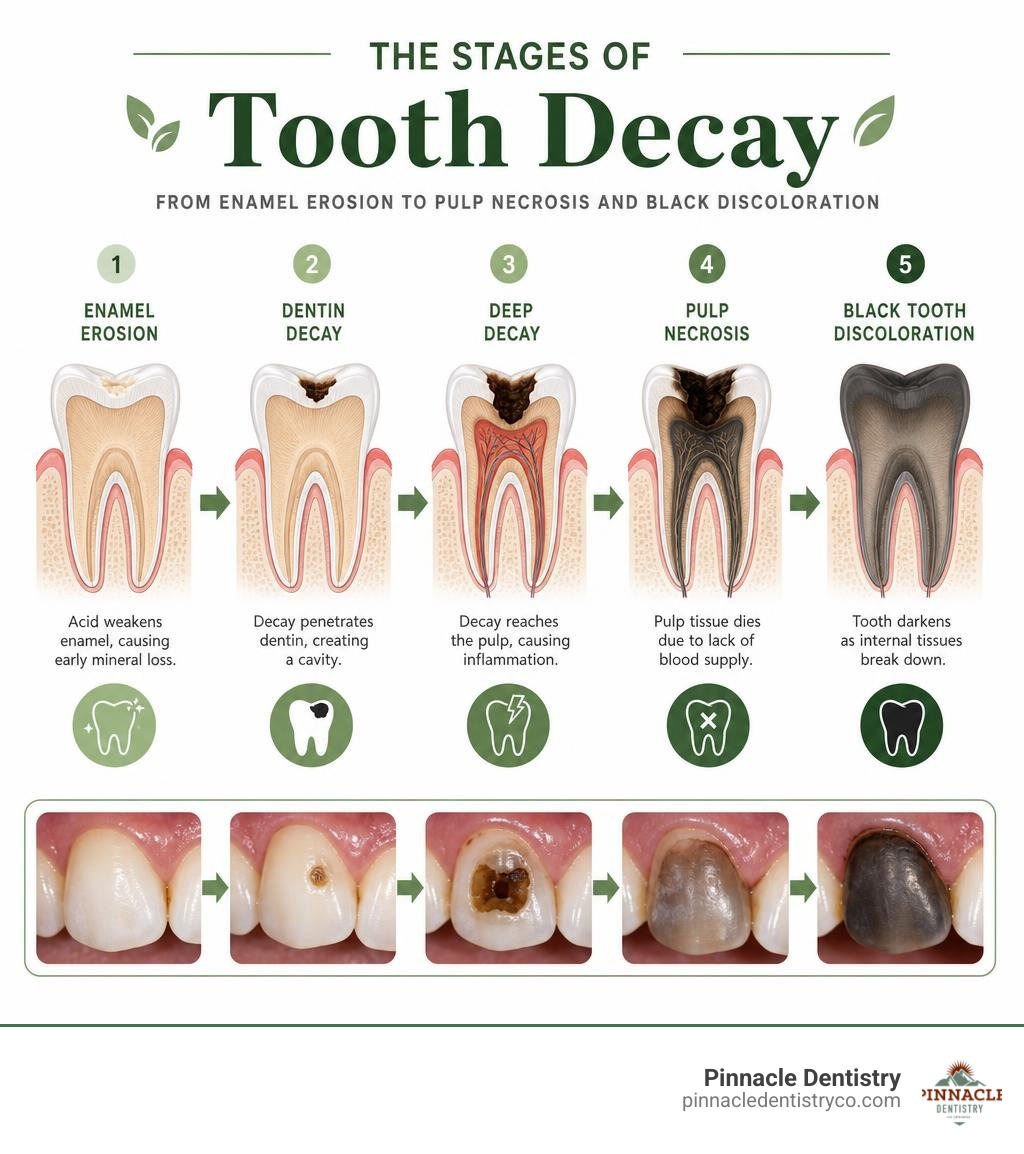 Infographic showing stages of tooth decay from enamel erosion to pulp necrosis and black tooth discoloration infographic