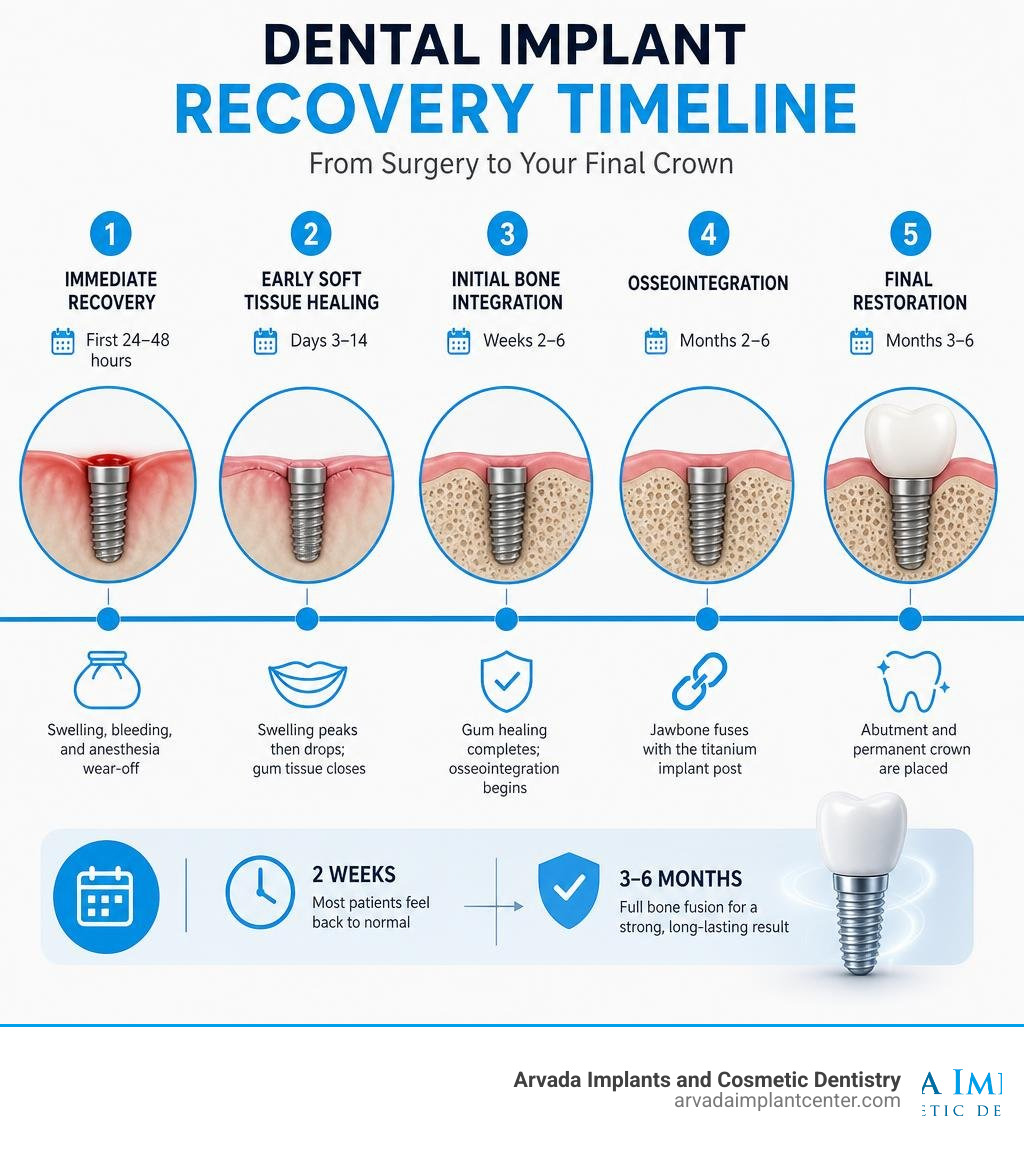 Dental implant recovery timeline infographic showing healing phases from surgery to final crown placement infographic