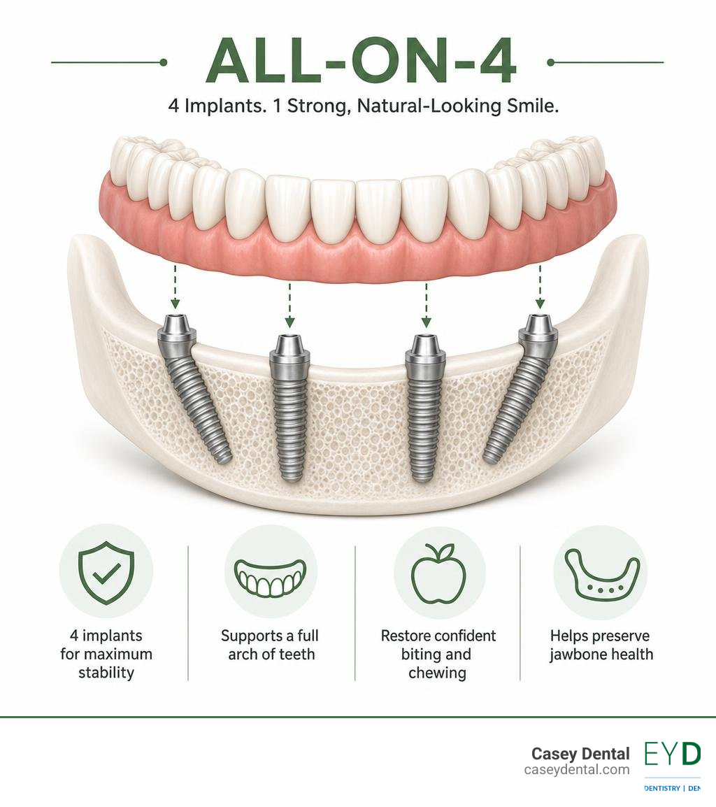 Infographic showing All-on-4 dental implant concept: 4 titanium posts support a full arch of teeth infographic