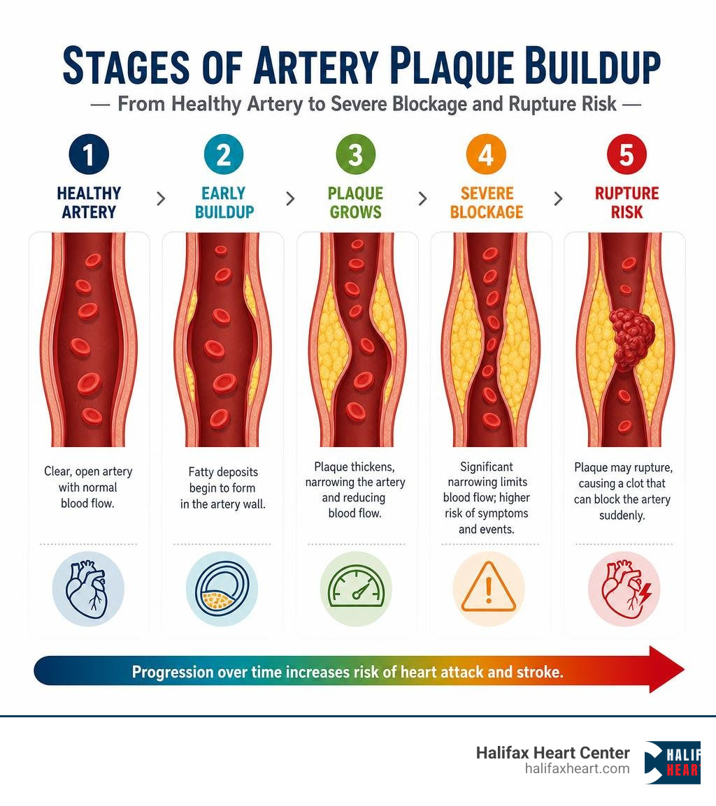 Stages of artery plaque buildup from healthy artery to severe blockage and rupture risk infographic
