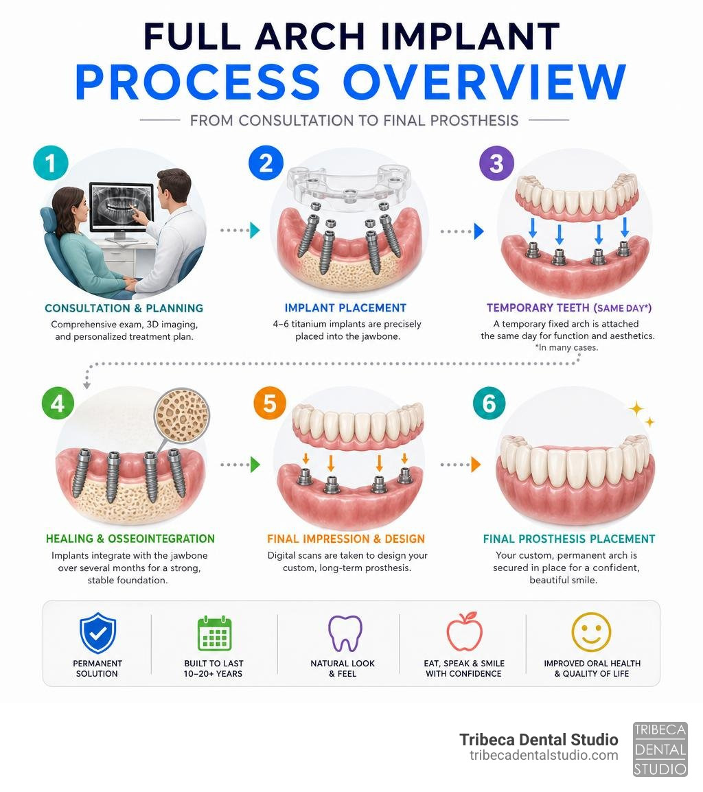 Full arch implant process overview infographic from consultation to final prosthesis infographic
