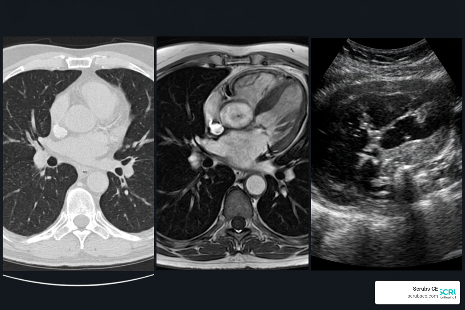 Multi-modality clinical scans comparison showing CT, MRI, and Ultrasound side-by-side Multi-modality clinical scans comparison showing CT, MRI, and Ultrasound side-by-side