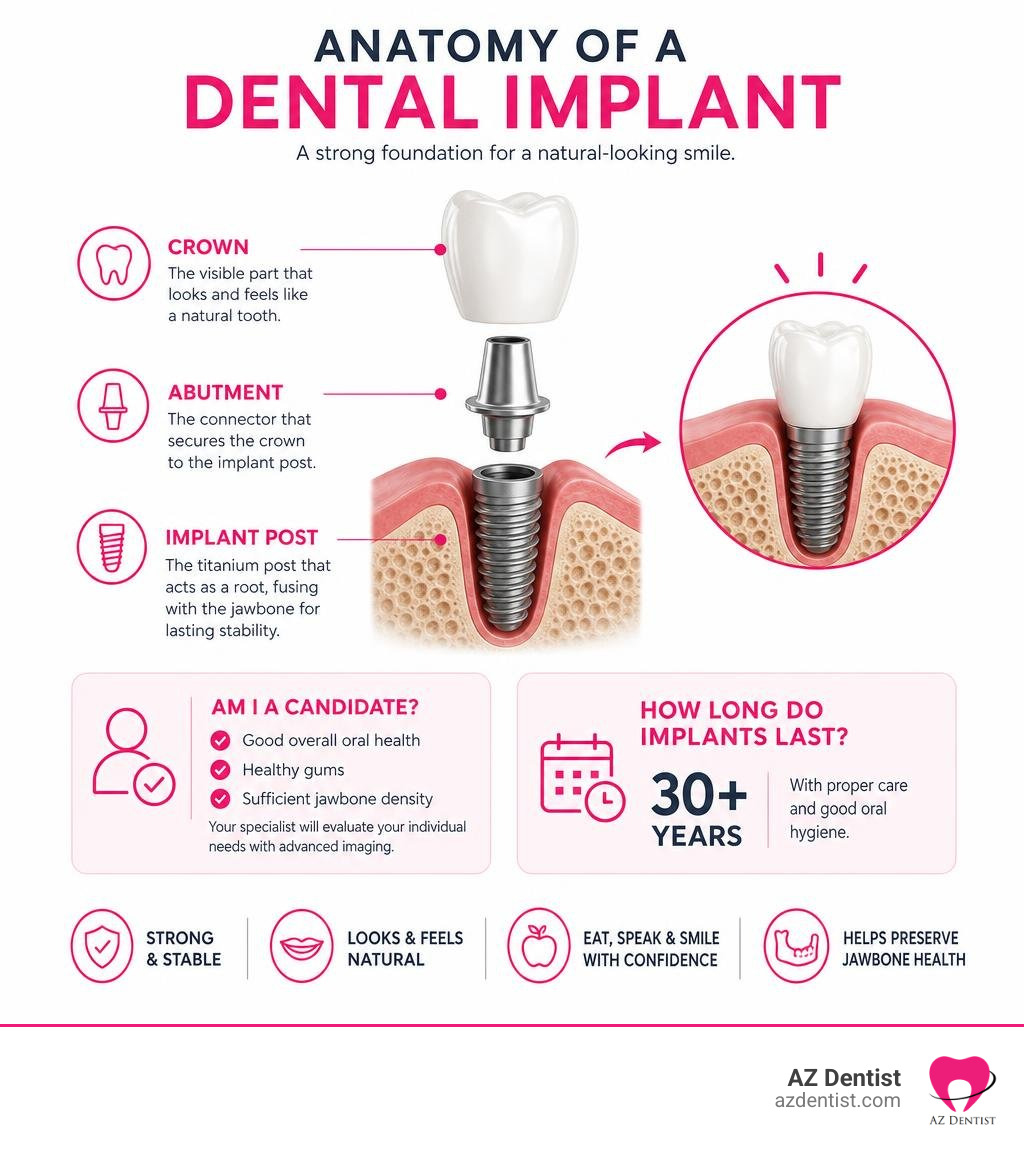 Anatomy of a dental implant showing post, abutment, and crown with candidacy and lifespan info infographic Anatomy of a dental implant showing post, abutment, and crown with candidacy and lifespan info infographic