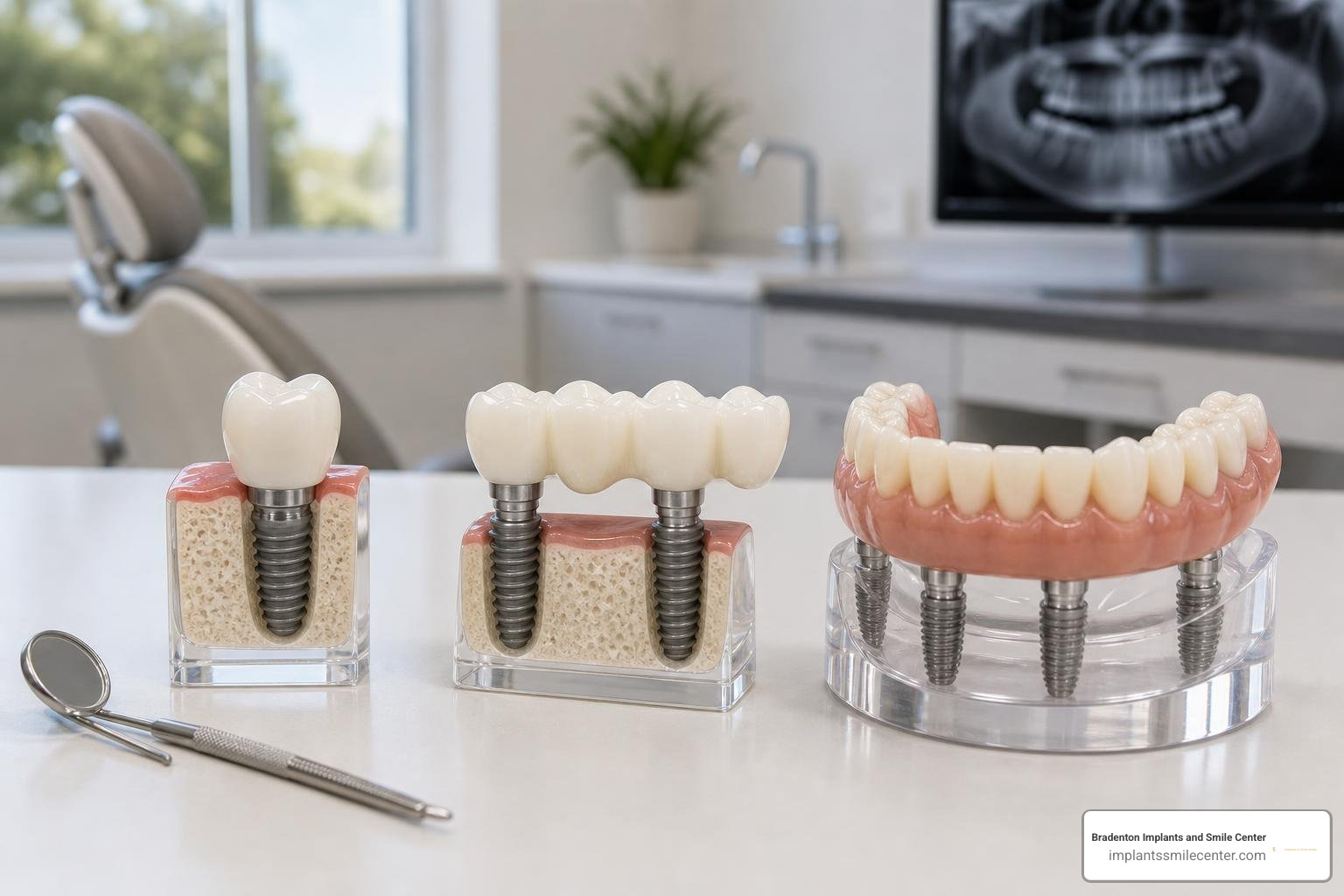 Different dental implant restoration options from single crowns to full arches