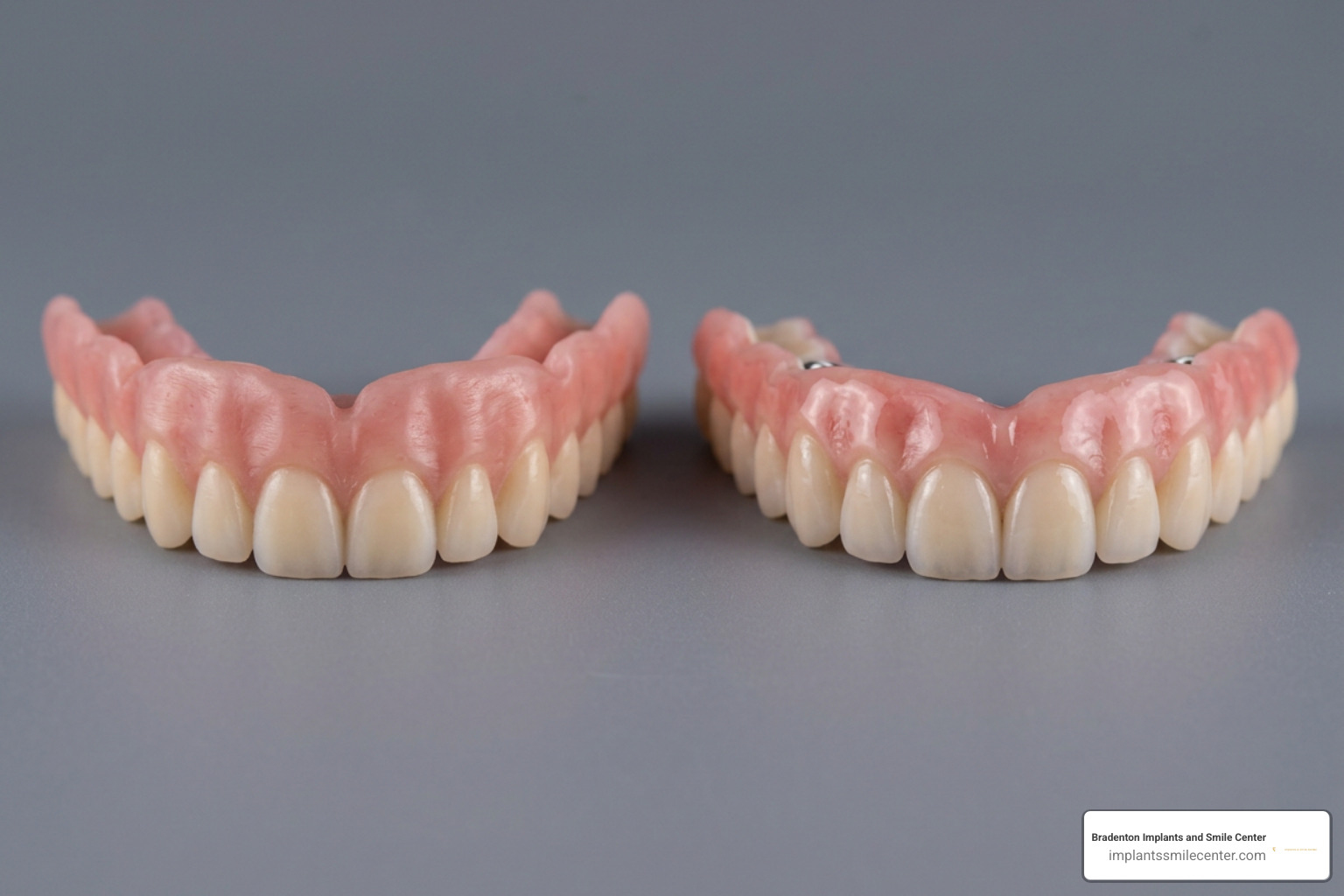 Comparison of PMMA acrylic and solid zirconia prosthetics