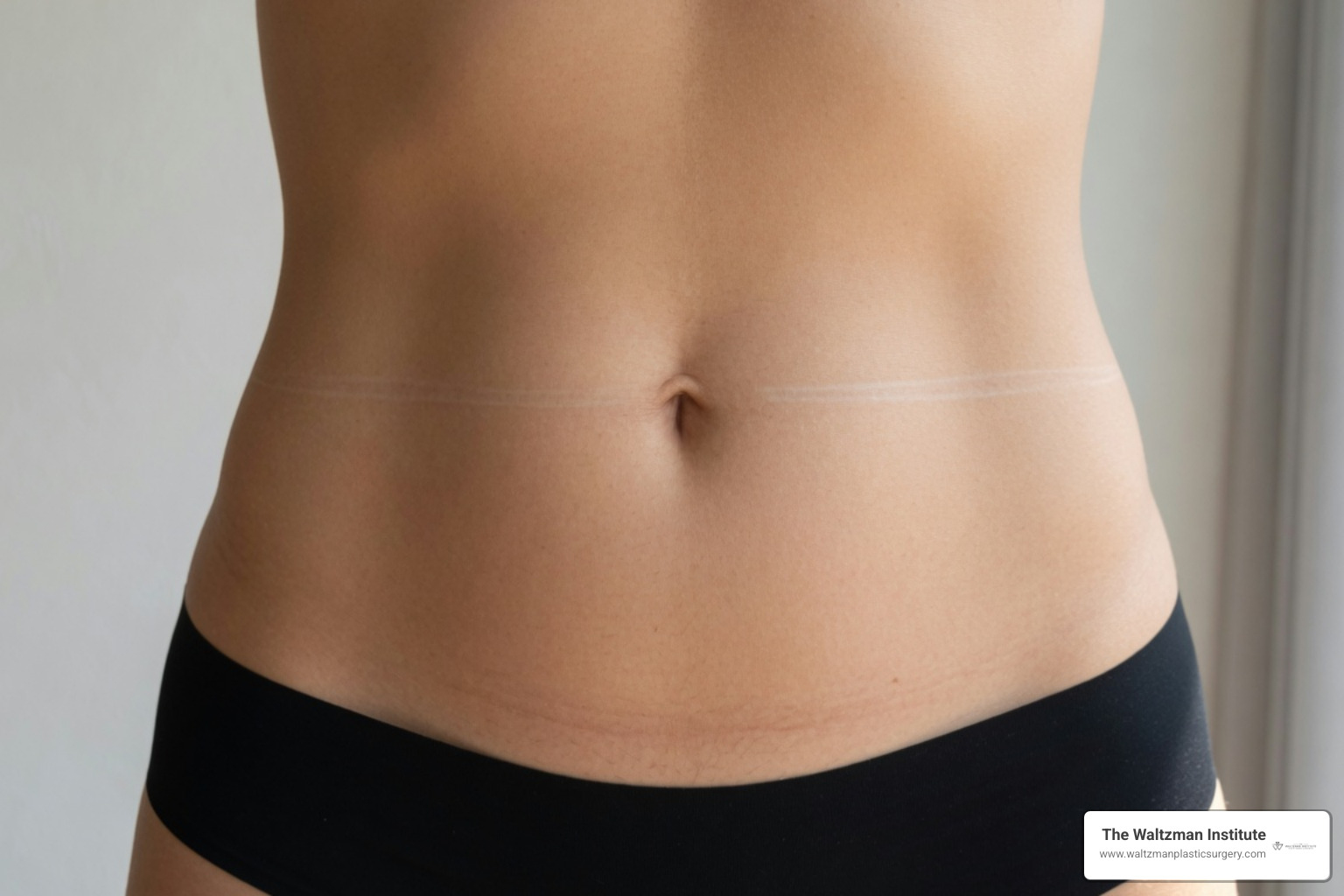 different types of tummy tuck procedures different types of tummy tuck procedures