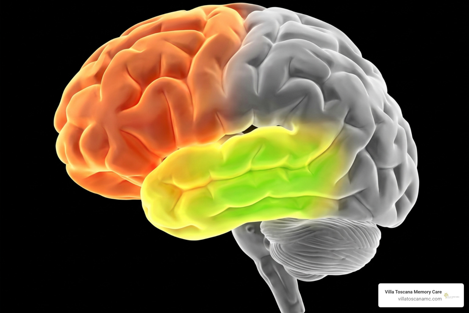 3D medical brain scan highlighting frontal and temporal lobes 3D medical brain scan highlighting frontal and temporal lobes