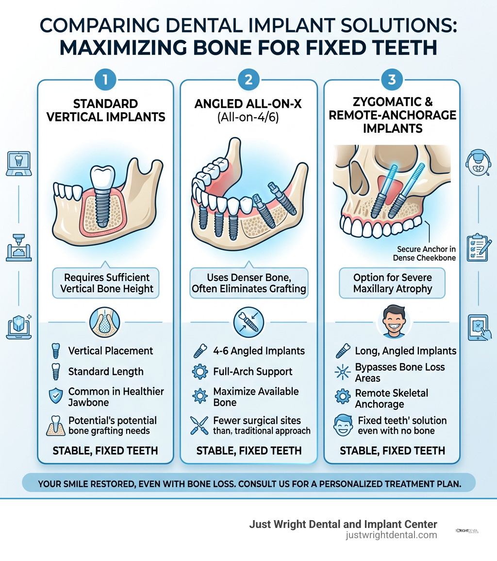 Infographic comparing standard vertical implants with angled All-on-X and zygomatic remote-anchorage implants infographic