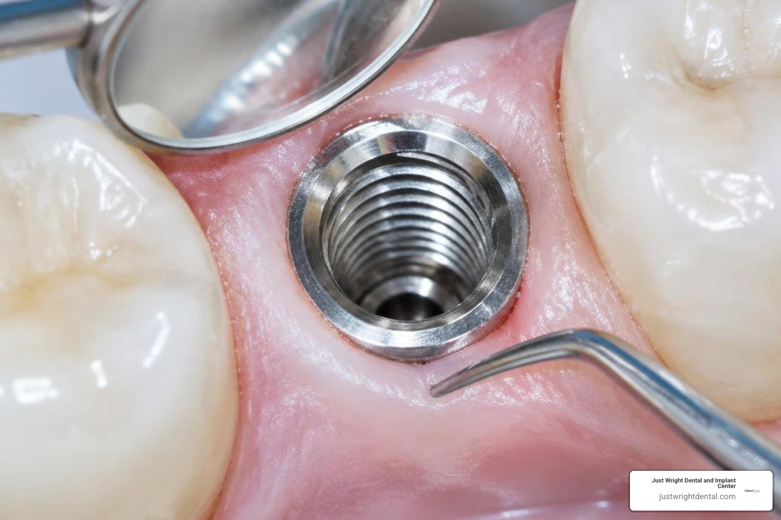 High-magnification inspection of an internal implant chamber High-magnification inspection of an internal implant chamber