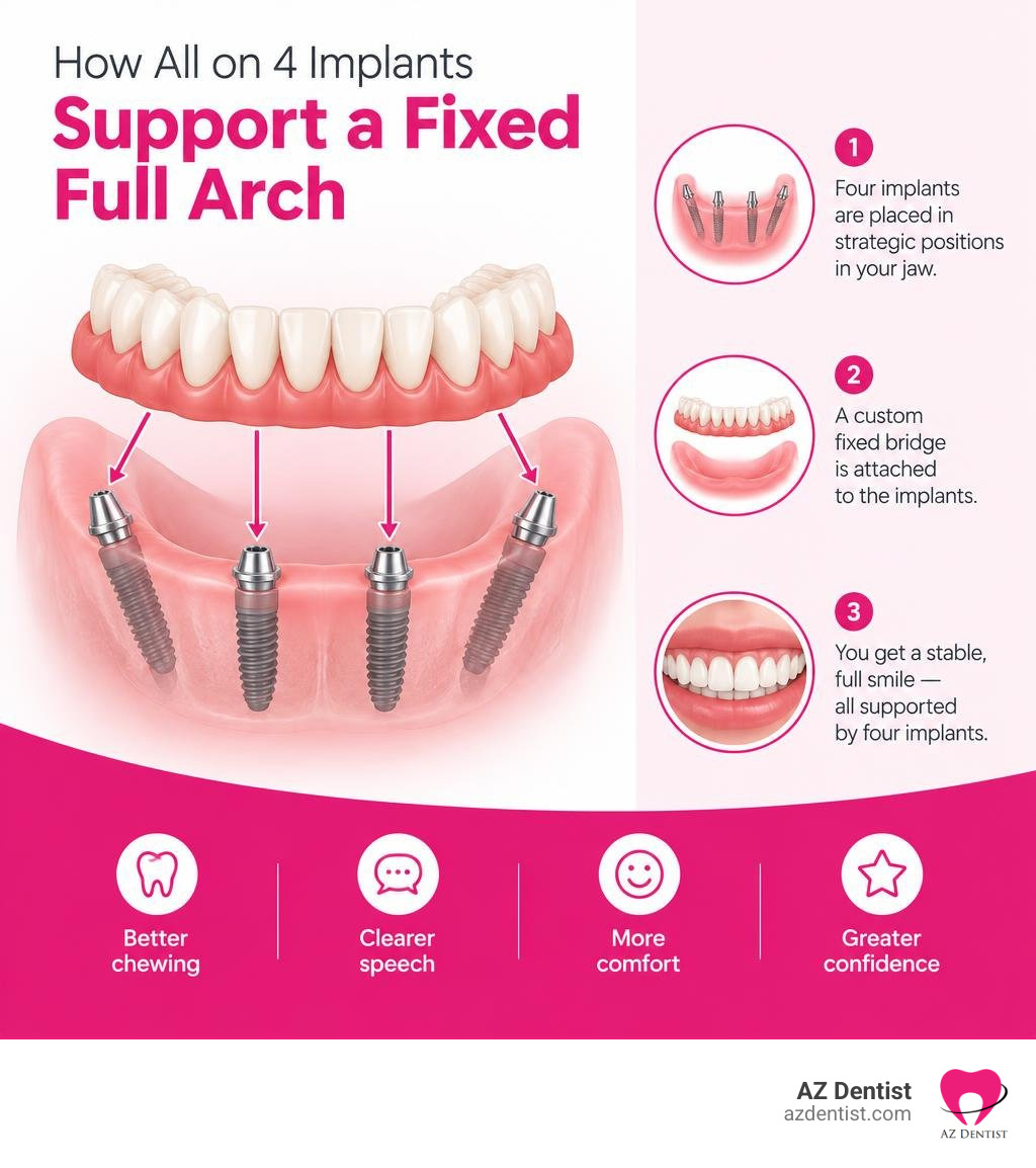 How All on 4 implants support a fixed full arch infographic