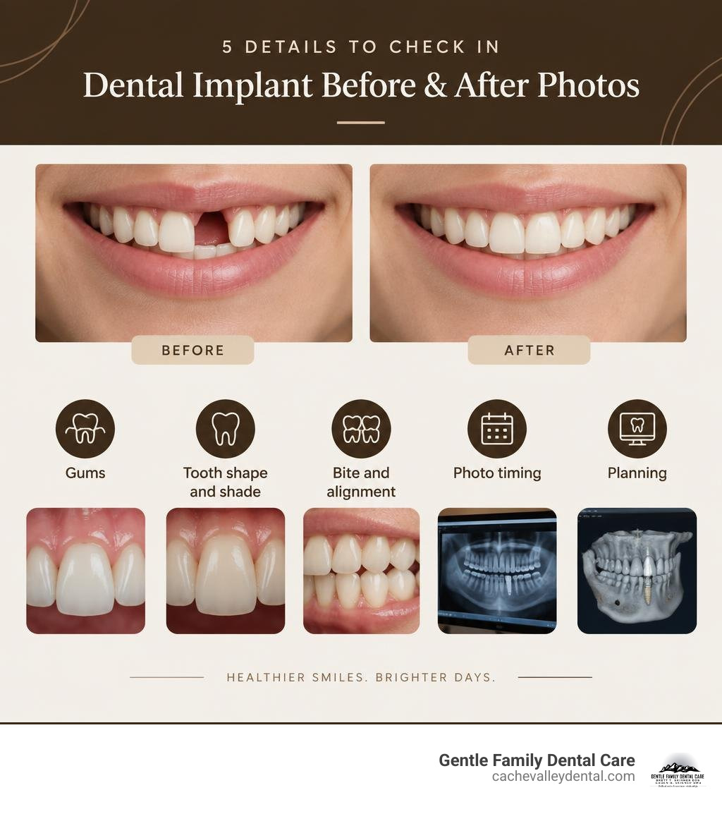 Infographic showing five details to check in dental implant before and after photos infographic Infographic showing five details to check in dental implant before and after photos infographic
