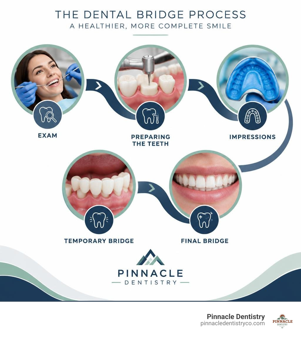 comparing traditional, cantilever, Maryland and implant-supported bridge designs infographic comparing traditional, cantilever, Maryland and implant-supported bridge designs infographic